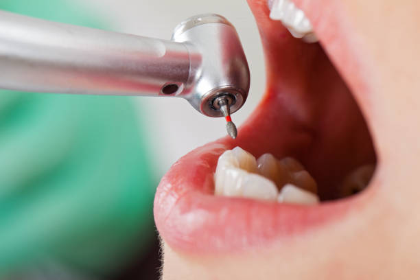 Best Emergency Denture Repair in Dodge City, KS